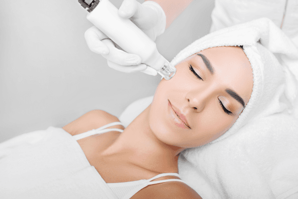 BEST MICRONEEDLING MARKETING FOR MED SPAS NEAR ME (600 x 400 px)