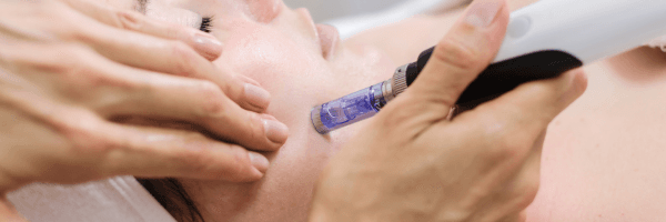 Local Med Spa Marketing Near Me (600 X 400 Px)